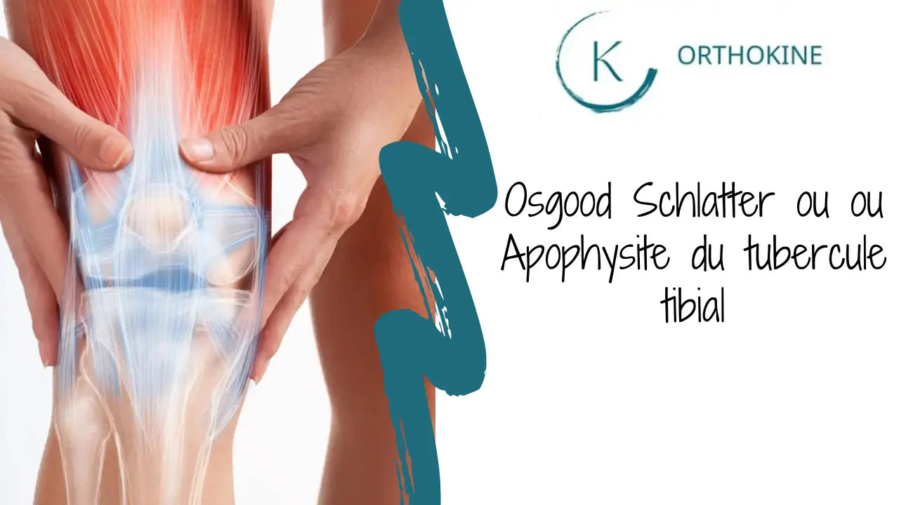 Osgood Schlatter ou ou Apophysite du tubercule tibial